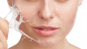 Chemical Peel Treatment Question and Answer