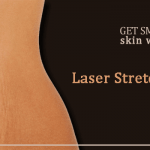 best stretch marks removal in delhi (1)
