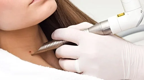 RM99: Permanent Face Mole Tattoo / Beauty Spot Mole Tattoo - Ally Beauty