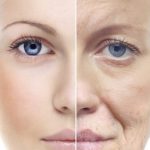 Anti-Aging Treatment in Delhi, Process, and benefits