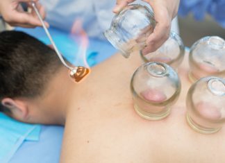 Cupping Therapy In Delhi, Procedure, Pros, and Cons