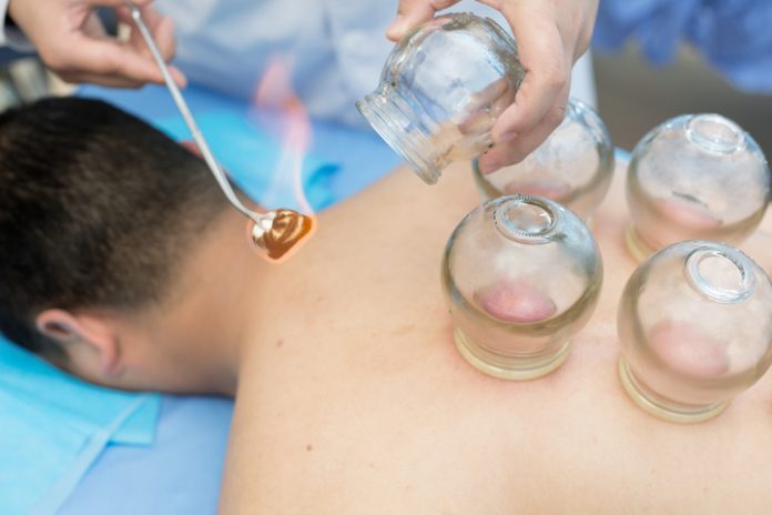 Cupping Therapy In Delhi, Procedure, Pros, and Cons Cupping Therapy In Delhi, Procedure, Pros, and Cons