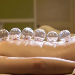 Cupping Therapy In Delhi, Procedure, Pros, and Cons