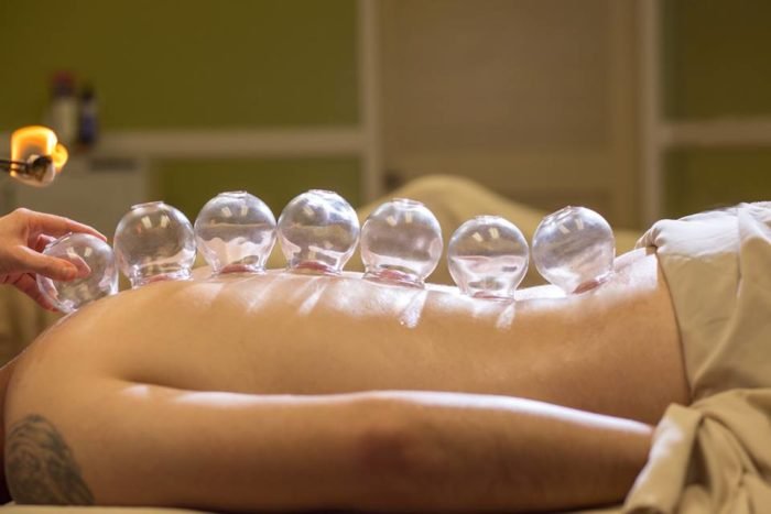 Cupping Therapy In Delhi, Procedure, Pros, and Cons | Adorable Clinic