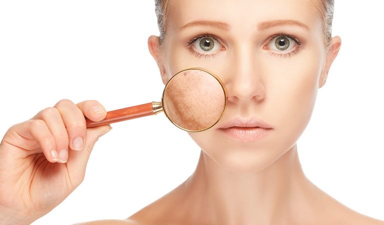 Laser Resurfacing Treatment Question and Answer