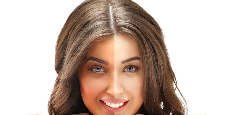 Skin Whitening Treatment Procedure Benefits and Cost