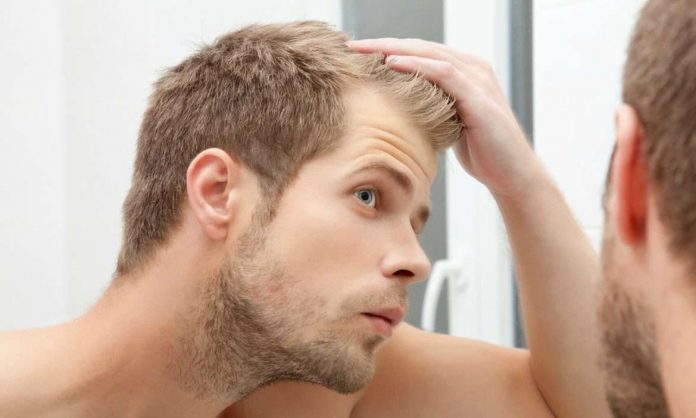Hair Loss Treatment Question and Answer, FAQ