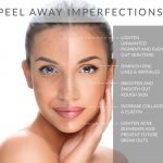 Chemical Peel Treatment And Its Types