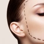 Dermal Fillers, Face Contouring Myths and Facts
