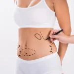Liposuction Treatment A Instant Weight Loss Procedure