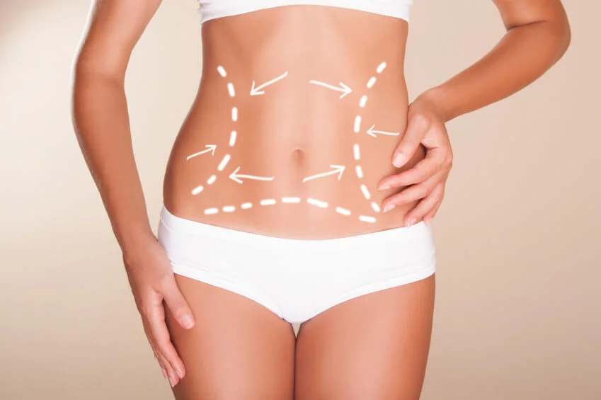 Liposuction Treatment A Instant Weight Loss Procedure