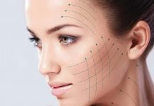Thread facelift Procedure, Myths and Facts