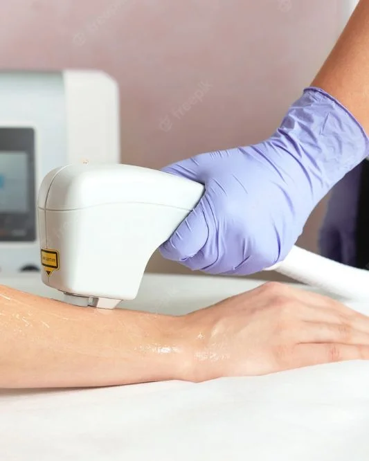 hand laser hair removal in delhi Adorable Clinic