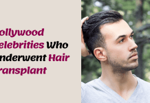 Bollywood Celebrities Who Transformed Their Look with Hair Transplant Surgery!