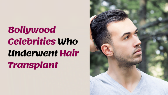 Bollywood Celebrities Who Transformed Their Look with Hair Transplant Surgery!